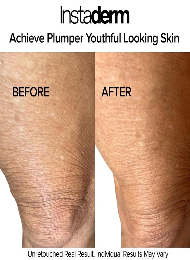 إنستاديرم كريم إنستاديرم كريب فيكس المُرمِّم للجسم - كريم مضاد للتجاعيد والشيخوخة، يدعم إنتاج الإيلاستين والكولاجين الطبيعيين للبشرة لاستعادة نضارتها، وشدّها، وترطيبها، وتنعيمها. 113 مل - Image 5